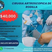 Promoción de cirugía artroscópica de rodilla