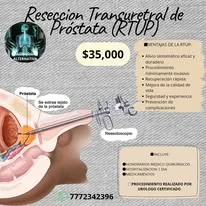 Promoción de resección transuretral de próstata RTUP